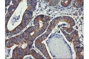 Image no. 2 for anti-Dynamin 1-Like (DNM1L) antibody (ABIN1497872) (Dynamin 1-Like Antikörper)