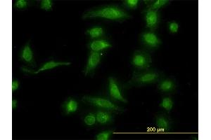 Immunofluorescence (IF) image for anti-Aldo-Keto Reductase Family 1, Member B10 (Aldose Reductase) (AKR1B10) (AA 76-143) antibody (ABIN566074)