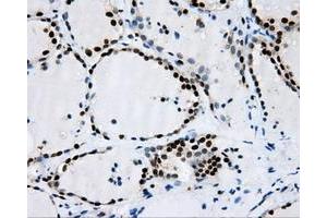 Image no. 3 for anti-Replication Protein A2, 32kDa (RPA2) antibody (ABIN1500733)