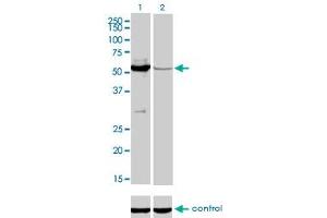 Western blot analysis of MUTYH over-expressed 293 cell line, cotransfected with MUTYH Validated Chimera RNAi (Lane 2) or non-transfected control (Lane 1).