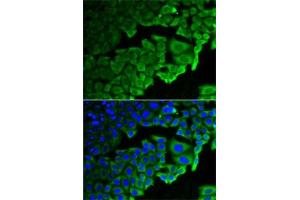 Immunofluorescence analysis of HeLa cells using RPLP0 antibody (ABIN6128686, ABIN6147163, ABIN6147165 and ABIN6221205). (RPLP0 Antikörper  (AA 1-317))