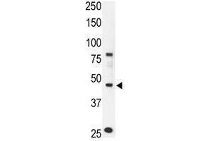 Image no. 2 for anti-Chemokine Binding Protein 2 (CCBP2) (N-Term) antibody (ABIN357385) (CCBP2 Antikörper  (N-Term))