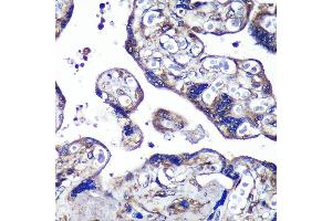 Immunohistochemistry of paraffin-embedded Human placenta using PASK Rabbit pAb (ABIN6128413, ABIN6145248, ABIN6145249 and ABIN6224850) at dilution of 1:100 (40x lens). (PASK Antikörper  (AA 1194-1323))