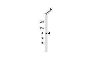 Anti-P1R3F Antibody (C-term) at 1:1000 dilution + human heart lysate Lysates/proteins at 20 μg per lane. (PPP1R3F Antikörper  (C-Term))