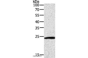 Western blot analysis of Hela cell, using SNAP25 Polyclonal Antibody at dilution of 1:400 (SNAP25 Antikörper)
