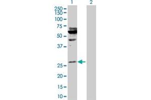 Western Blot analysis of HOXA5 expression in transfected 293T cell line by HOXA5 MaxPab polyclonal antibody. (HOXA5 Antikörper  (AA 1-270))