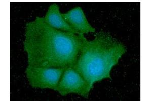 ICC/IF analysis of IDH1 in Hep3B cells line, stained with DAPI (Blue) for nucleus staining and monoclonal anti-human IDH1 antibody (1:100) with goat anti-mouse IgG-Alexa fluor 488 conjugate (Green). (IDH1 Antikörper  (AA 1-414))