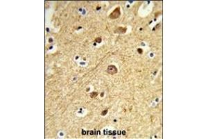 Immunohistochemistry (Paraffin-embedded Sections) (IHC (p)) image for anti-Mitogen-Activated Protein Kinase 8 Interacting Protein 1 (MAPK8IP1) (AA 470-498), (C-Term) antibody (ABIN652961)