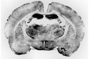 High magnification image in rat cortex (HTR2C Antikörper  (AA 439-460))
