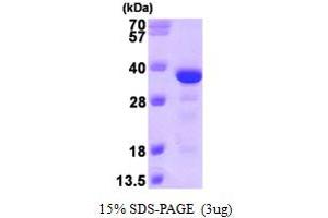 SDS-PAGE (SDS) image for Microtubule-Associated Protein, RP/EB Family, Member 3 (MAPRE3) (AA 1-281) protein (His tag) (ABIN667236)