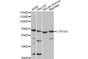 Western blot analysis of extracts of various cell lines, using CYP3A5 Antibody (ABIN2736613) at 1:1000 dilution. (CYP3A5 Antikörper)