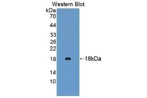 Detection of Recombinant TRAPPC2, Human using Polyclonal Antibody to Trafficking Protein Particle Complex 2 (TRAPPC2) (TRAPPC2 Antikörper  (AA 1-140))