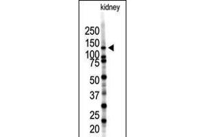Western blot analysis of SENP7 polyclonal antibody in mouse kidney tissue lysate (35ug/lane). (SENP7 Antikörper  (C-Term))