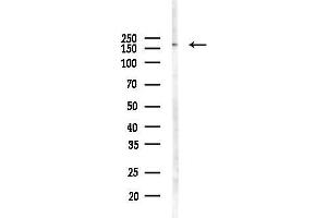 anti-ATP Binding Cassette Transporter A3 (ABCA3) (Internal Region) antibody
