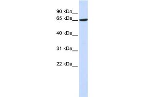 WB Suggested Anti-ADAM9 Antibody Titration:  0. (ADAM9 Antikörper  (Middle Region))