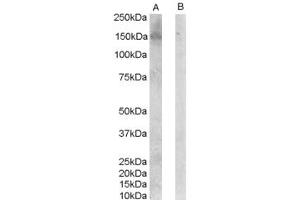 ABIN185461 (0. (ERBB3 Antikörper  (C-Term))