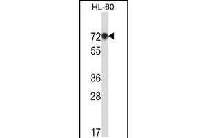 Western blot analysis in HL-60 cell line lysates (35ug/lane). (RBM39 Antikörper  (N-Term))
