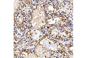 IHC analysis of Glycogen synthase 1/GYS1 using anti-Glycogen synthase 1/GYS1 antibody (ABIN7602155).