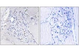 Immunohistochemistry (IHC) image for anti-Chromosome 9 Open Reading Frame 89 (C9orf89) (AA 21-70) antibody (ABIN2890155)