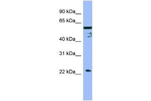 WB Suggested Anti-FAIM  Antibody Titration: 0.