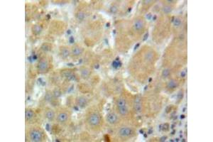 IHC-P analysis of Liver tissue, with DAB staining. (Factor XI Antikörper  (AA 170-398))