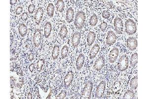 IHC analysis of KIFC1 using anti-KIFC1 antibody (ABIN7599523). (KIFC1 Antikörper  (AA 1-673))