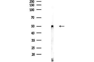 anti-Ring Finger Protein 38 (RNF38) antibody