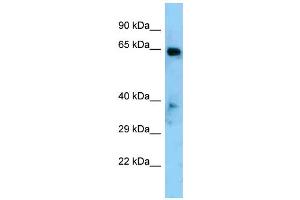 Western Blotting (WB) image for anti-Eyes Absent Homolog 1 (EYA1) (Middle Region) antibody (ABIN2779641) (EYA1 Antikörper  (Middle Region))