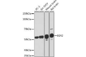 Western blot analysis of extracts of various cell lines, using EGR2 Rabbit mAb (ABIN1682321, ABIN7101509, ABIN7101510 and ABIN7101511) at 1:1000 dilution. (EGR2 Antikörper)