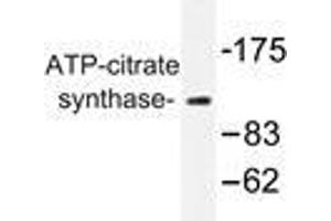 Western blot analysis of ATP-citrate synthase antibody in extracts from COS7 cells. (ACLY Antikörper)