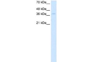 WB Suggested Anti-CTDSPL Antibody Titration:  0. (CTDSPL Antikörper  (N-Term))