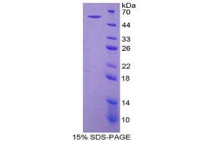 SDS-PAGE (SDS) image for Ectonucleoside Triphosphate diphosphohydrolase 1 (ENTPD1) (AA 213-452) protein (His tag,GST tag) (ABIN1879474)