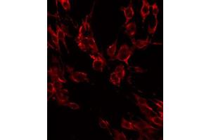ABIN6268687 staining HeLa by IF/ICC. (IL2 Receptor beta Antikörper  (N-Term))