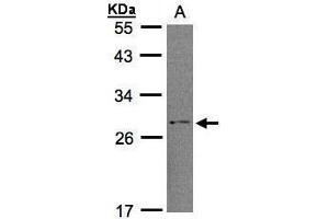 WB Image Sample (30μg whole cell lysate) A:H1299 12% SDS PAGE antibody diluted at 1:1000 (RGS2 Antikörper)