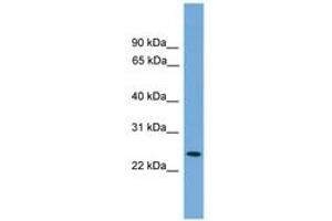 Image no. 1 for anti-Proteasome (Prosome, Macropain) Activator Subunit 2 (PA28 Beta) (PSME2) (AA 143-192) antibody (ABIN6746452) (PSME2 Antikörper  (AA 143-192))