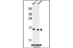 Western blot analysis of SNRPD3 Antibody in MCF-7, Jurkat cell line lysates (35ug/lane) (SNRPD3 Antikörper  (C-Term))