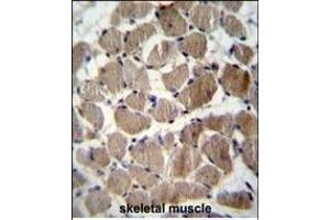 COCH Antibody (Center) (ABIN656833 and ABIN2846042) immunohistochemistry analysis in formalin fixed and paraffin embedded human skeletal muscle followed by peroxidase conjugation of the secondary antibody and DAB staining. (COCH Antikörper  (AA 399-428))