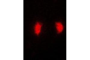 Immunofluorescent analysis of MRNP41 staining in MCF7 cells. (RAE1 Antikörper)