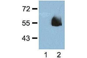 1:1000 (1 ug/ml) antibody dilution probed against HEK 293 cells transfected with HA-tagged protein vector; unstransfected (1) and transfected (2). (Hemagglutinin Antikörper)