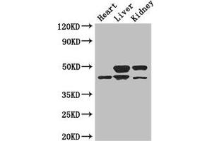 Western Blot Positive WB detected in: Mouse heart tissue, Mouse liver tissue, Mouse kidney tissue All lanes: TGIF1 antibody at 3 μg/mL Secondary Goat polyclonal to rabbit IgG at 1/50000 dilution Predicted band size: 44, 30, 32, 28 kDa Observed band size: 44, 50 kDa (TGIF1 Antikörper  (AA 8-375))