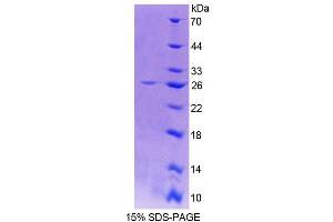 SDS-PAGE (SDS) image for Cathepsin O (CTSO) (AA 111-317) protein (His tag) (ABIN6239532)