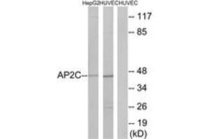 Western blot analysis of extracts from HepG2/HuvEc cells, using AP2C Antibody. (TFAP2C Antikörper  (AA 401-450))