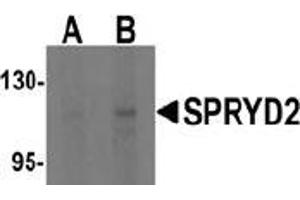 Western blot analysis of SPRYD2 in rat brain tissue lysate with SPRYD2 antibody at (A) 1 and (B) 2 μg/ml (CMYA5 Antikörper  (C-Term))