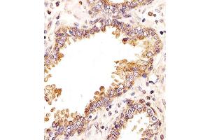 Immunohistochemical analysis of paraffin-embedded H. (ZRSR2 Antikörper  (C-Term))