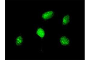 Immunofluorescence of monoclonal antibody to HOXA5 on HeLa cell. (HOXA5 Antikörper  (AA 171-270))