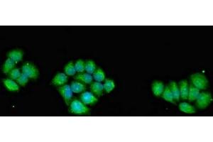 Immunofluorescent analysis of PC-3 cells using ABIN7142682 at dilution of 1:100 and Alexa Fluor 488-congugated AffiniPure Goat Anti-Rabbit IgG(H+L)