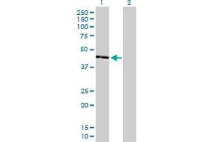 Western Blot analysis of UQCRC2 expression in transfected 293T cell line by UQCRC2 MaxPab polyclonal antibody. (UQCRC2 Antikörper  (AA 1-453))