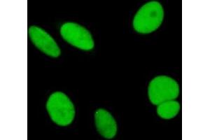 Immunofluorescence of purified MaxPab antibody to SAE1 on HeLa cell. (SAE1 Antikörper  (AA 1-346))