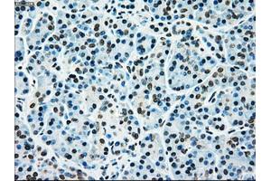 Immunohistochemical staining of paraffin-embedded liver tissue using anti-MAP2K4mouse monoclonal antibody. (MAP2K4 Antikörper)