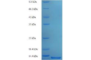 SDS-PAGE (SDS) image for Histone H2B Type 2-E (HIST2H2BE) (AA 2-93) protein (His tag) (ABIN5714152)